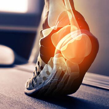 Fuß im Turnschuh, Knochen als Schema im Fuß dargestellt